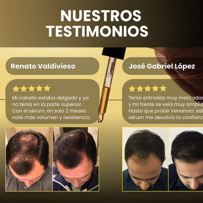 Serum Venanoci® – Recupera tu seguridad al instante